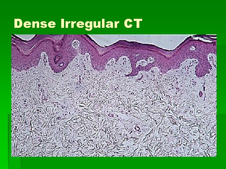 Dense Irregular CT Dense Irregular CT