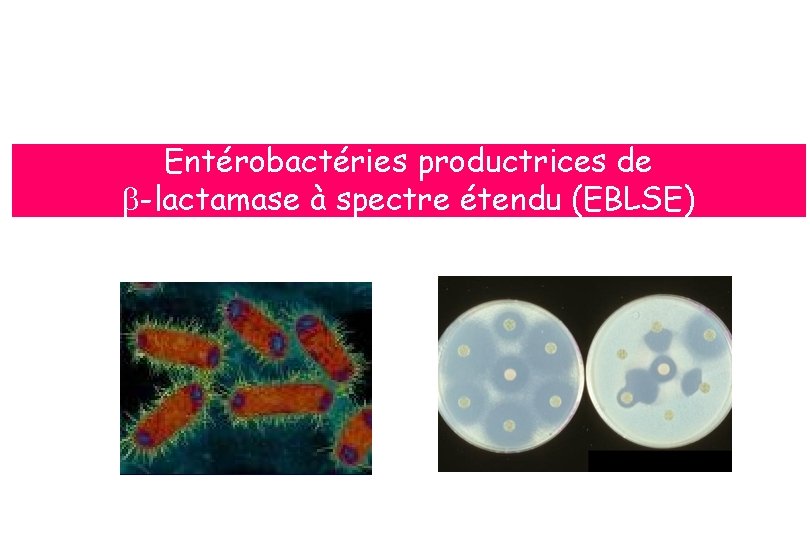 Entérobactéries productrices de b-lactamase à spectre étendu (EBLSE) 