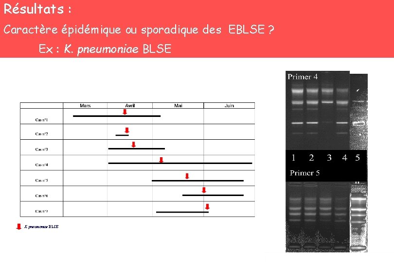 Résultats : Caractère épidémique ou sporadique des EBLSE ? Ex : K. pneumoniae BLSE