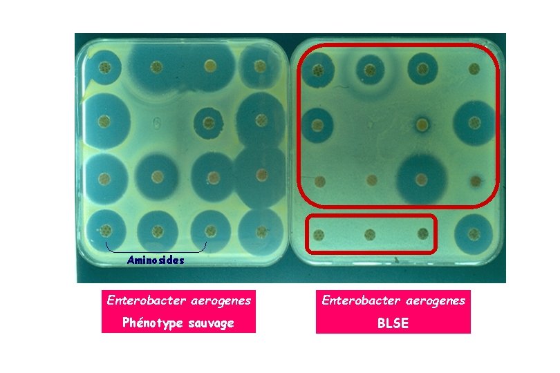 Aminosides Enterobacter aerogenes Phénotype sauvage BLSE 