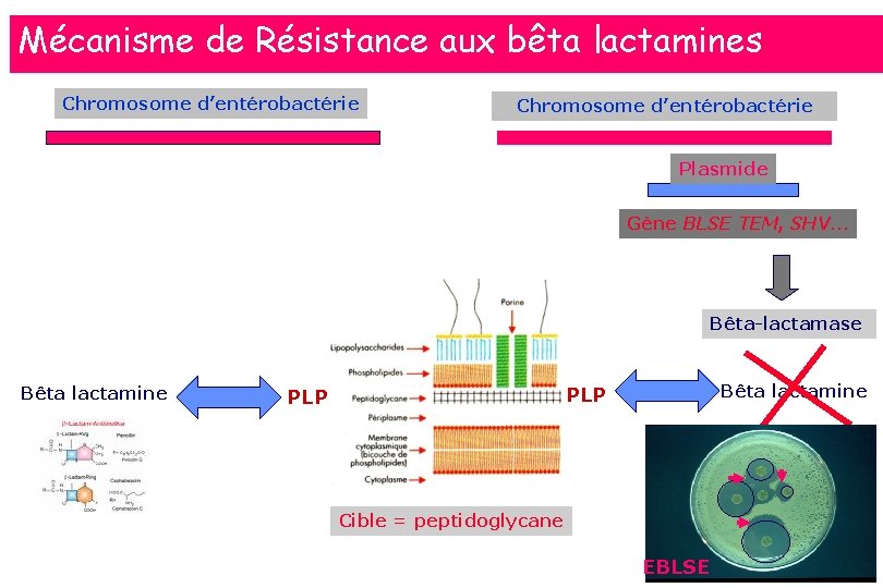 Mécanisme de Résistance aux bêta lactamines Chromosome d’entérobactérie Plasmide Gène BLSE TEM, SHV… Bêta-lactamase