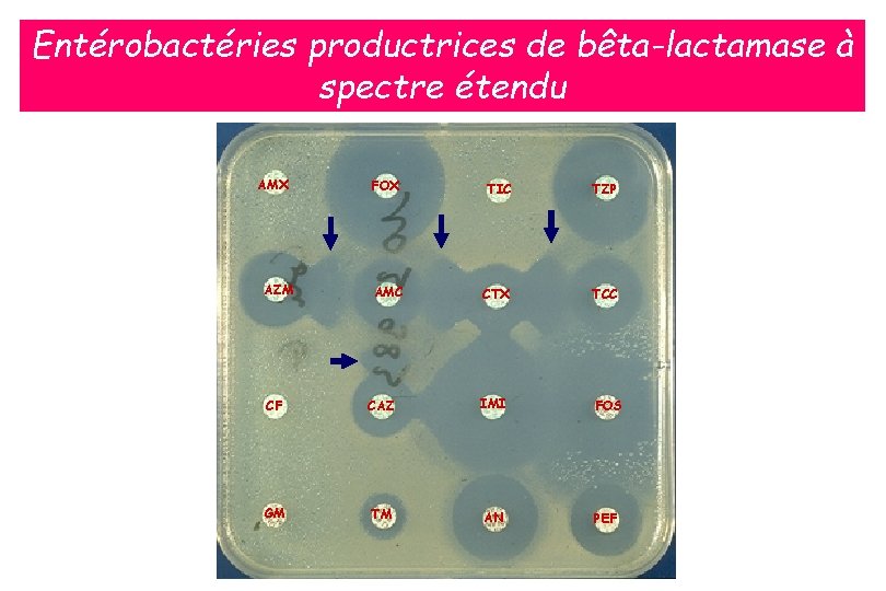 Entérobactéries productrices de bêta-lactamase à spectre étendu AMX AZM FOX TIC TZP AMC CTX