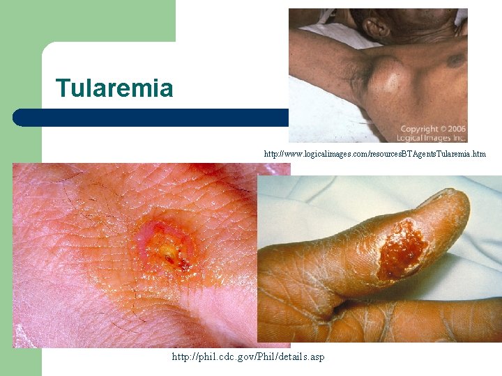 Tularemia http: //www. logicalimages. com/resources. BTAgents. Tularemia. htm http: //phil. cdc. gov/Phil/details. asp 