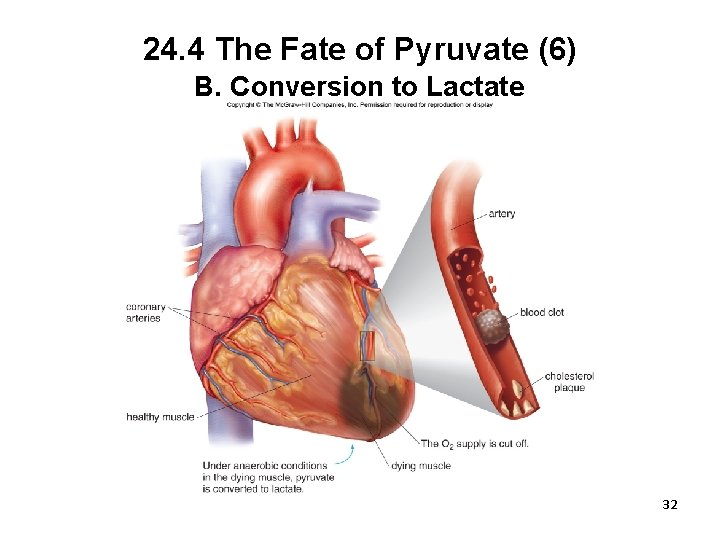 24. 4 The Fate of Pyruvate (6) B. Conversion to Lactate 32 