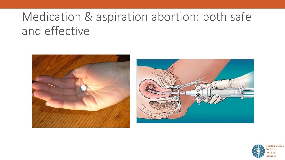 Medication & aspiration abortion: both safe and effective 