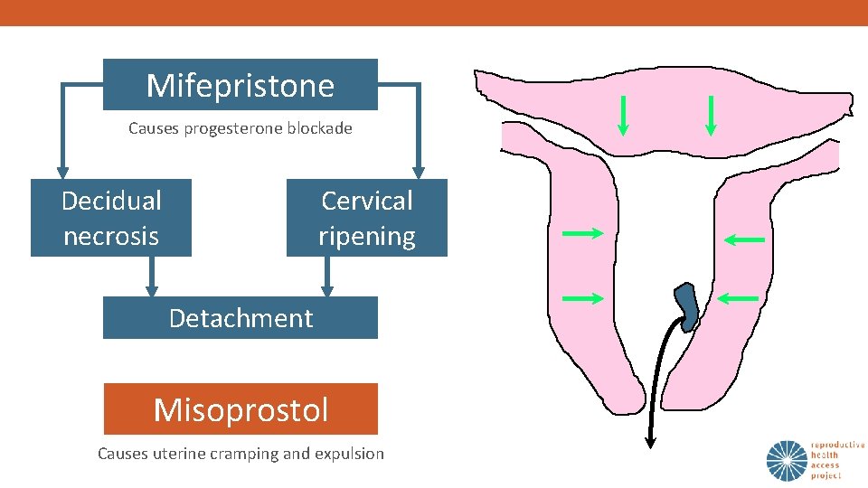 Mifepristone Causes progesterone blockade Decidual necrosis Cervical ripening Detachment Misoprostol Causes uterine cramping and