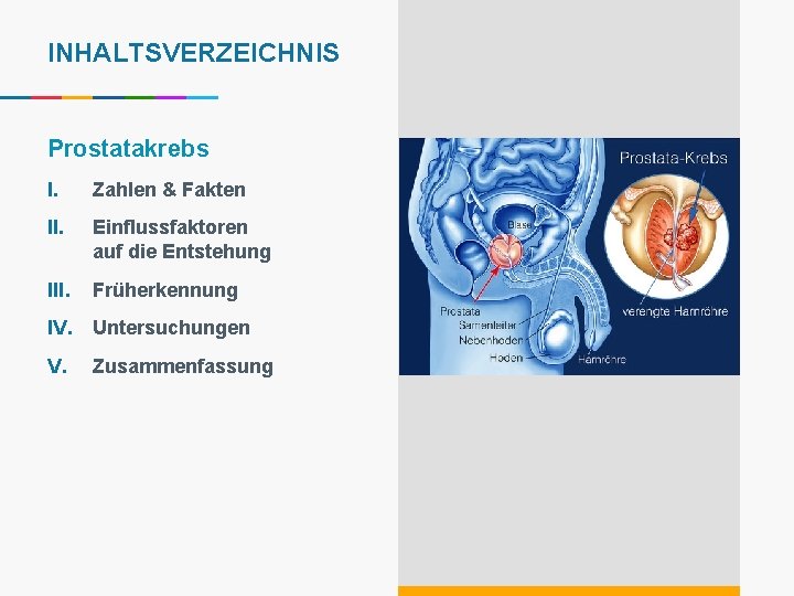 INHALTSVERZEICHNIS Prostatakrebs I. Zahlen & Fakten II. Einflussfaktoren auf die Entstehung III. Früherkennung IV.