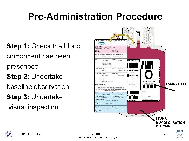 Pre-Administration Procedure Step 1: Check the blood component has been prescribed Step 2: Undertake