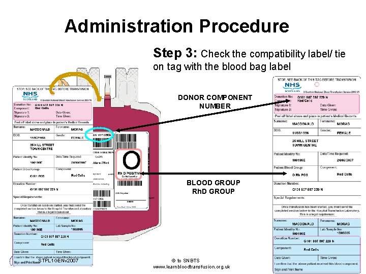 Administration Procedure Step 3: Check the compatibility label/ tie on tag with the blood