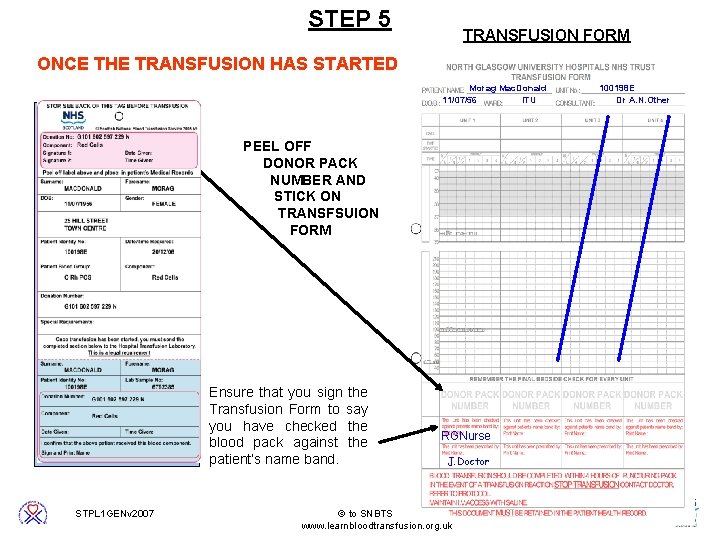 STEP 5 TRANSFUSION FORM ONCE THE TRANSFUSION HAS STARTED Morag Mac. Donald 11/07/56 ITU