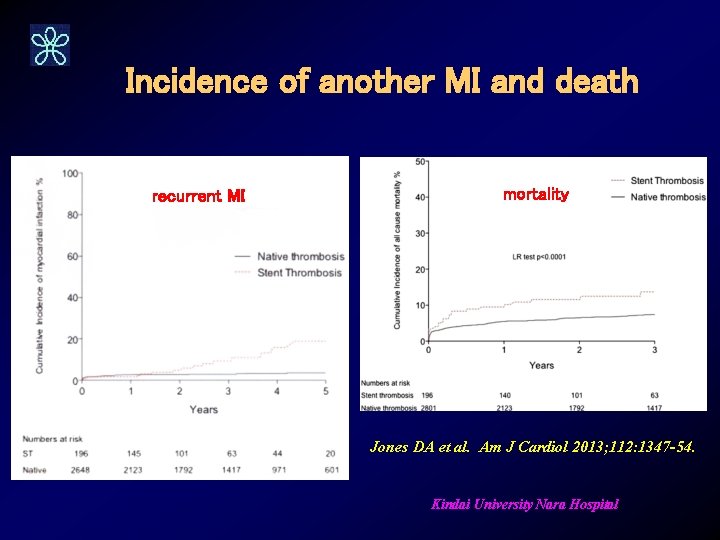 Incidence of another MI and death recurrent MI mortality Jones DA et al. Am
