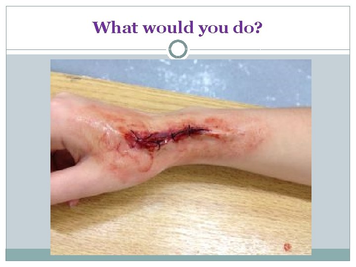 What would you do? What would you do?