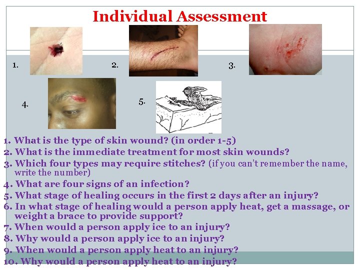 Individual Assessment 1. 2. 4. 3. 5. . is the type of skin wound? Individual Assessment 1. 2. 4. 3. 5. . is the type of skin wound?