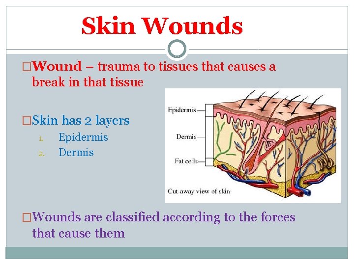 Skin Wounds �Wound – trauma to tissues that causes a break in that tissue Skin Wounds �Wound – trauma to tissues that causes a break in that tissue