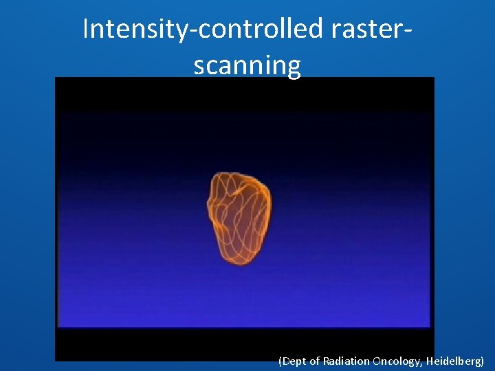 Intensity-controlled rasterscanning (Dept of Radiation Oncology, Heidelberg) 