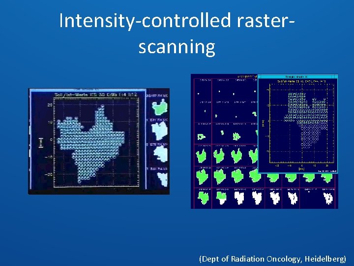 Intensity-controlled rasterscanning (Dept of Radiation Oncology, Heidelberg) 