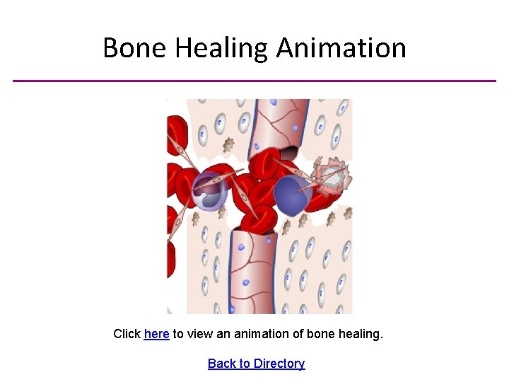 Bone Healing Animation Click here to view an animation of bone healing. Back to