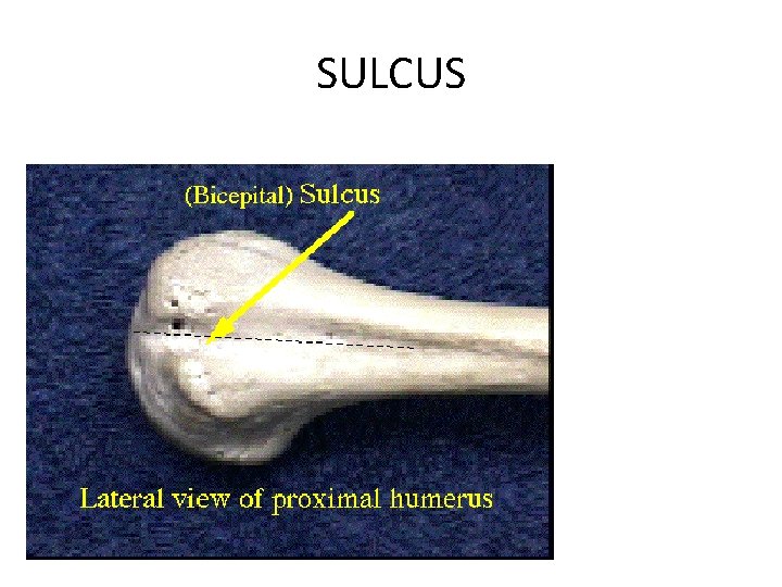 SULCUS 