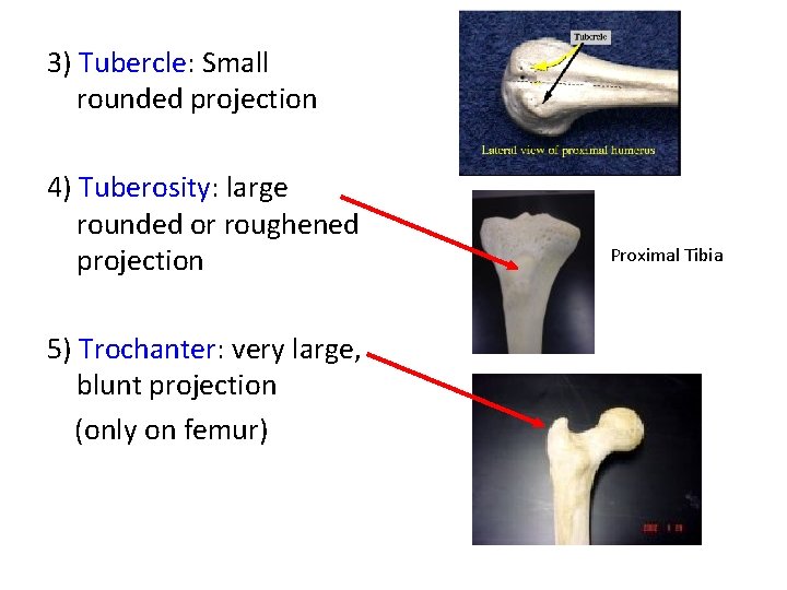 3) Tubercle: Small rounded projection 4) Tuberosity: large rounded or roughened projection 5) Trochanter: