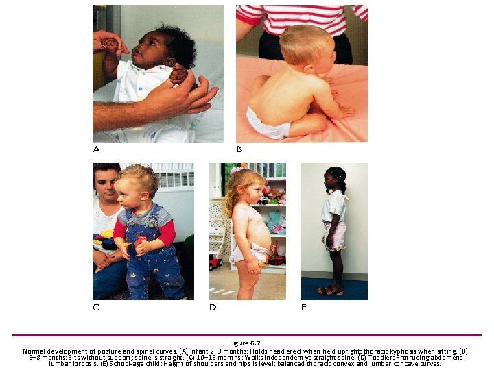 Figure 6. 7 Normal development of posture and spinal curves. (A) Infant 2– 3