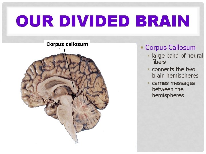 OUR DIVIDED BRAIN Corpus callosum § Corpus Callosum § large band of neural fibers