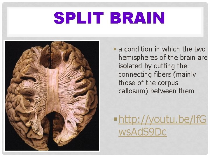 SPLIT BRAIN § a condition in which the two hemispheres of the brain are
