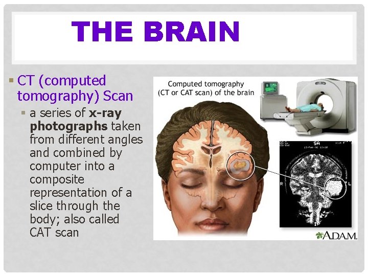 THE BRAIN § CT (computed tomography) Scan § a series of x-ray photographs taken