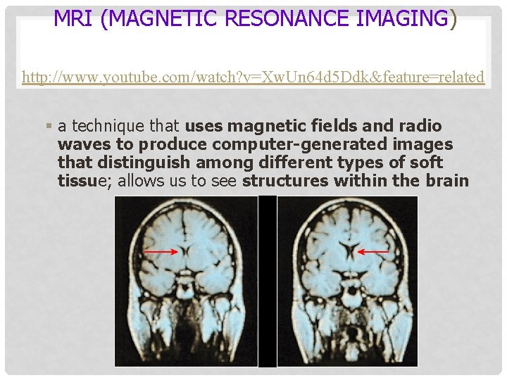 MRI (MAGNETIC RESONANCE IMAGING) http: //www. youtube. com/watch? v=Xw. Un 64 d 5 Ddk&feature=related