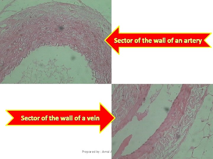 Sector of the wall of an artery Sector of the wall of a vein