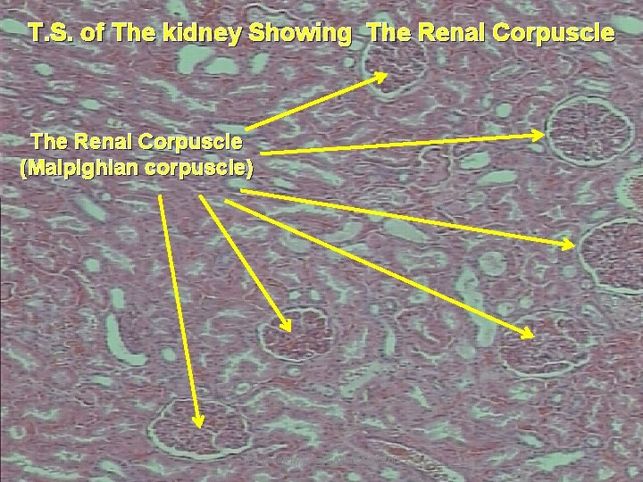 T. S. of The kidney Showing The Renal Corpuscle (Malpighian corpuscle) Prepared by :