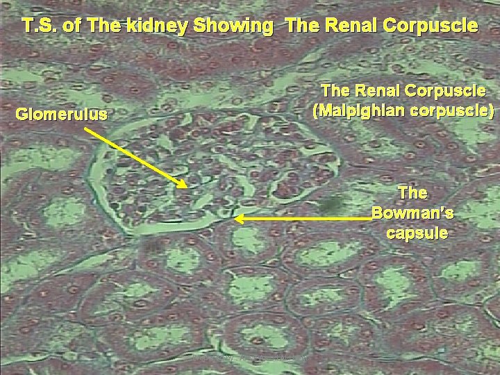 T. S. of The kidney Showing The Renal Corpuscle (Malpighian corpuscle) Glomerulus The Bowman’s