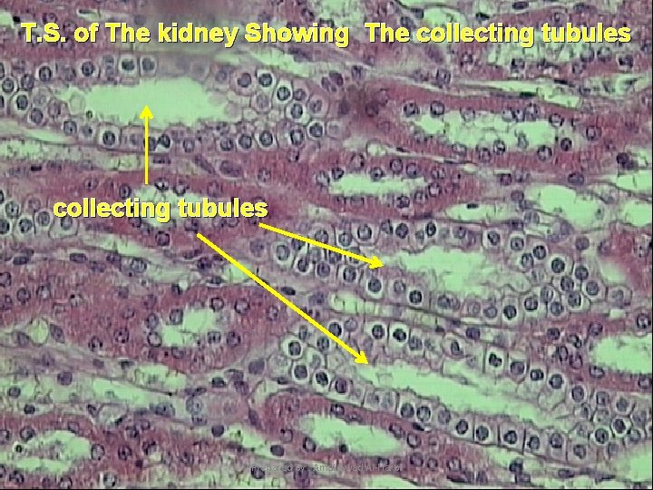 T. S. of The kidney Showing The collecting tubules Prepared by : Amal Awad