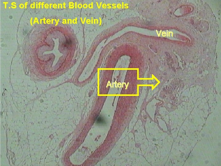 T. S of different Blood Vessels (Artery and Vein) Vein Artery Prepared by :