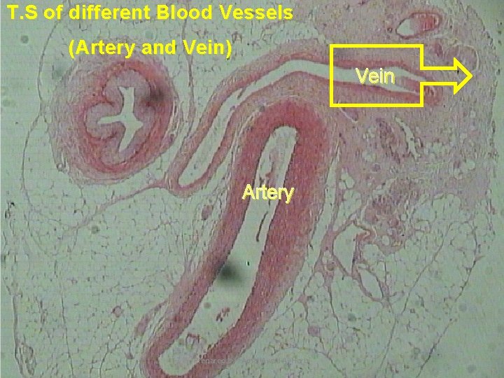 T. S of different Blood Vessels (Artery and Vein) Vein Artery Prepared by :