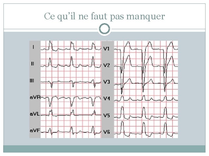 Ce qu’il ne faut pas manquer 