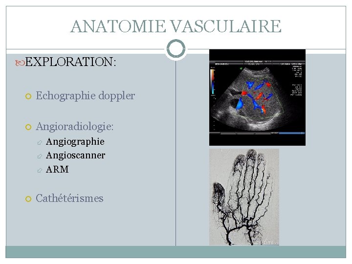 ANATOMIE VASCULAIRE EXPLORATION: Echographie doppler Angioradiologie: Angiographie Angioscanner ARM Cathétérismes 