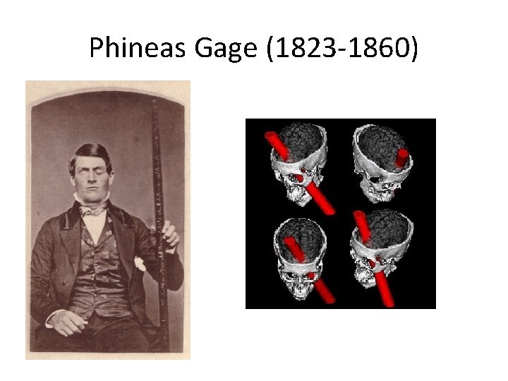 Phineas Gage (1823 -1860) 