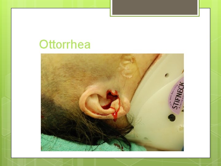 Ottorrhea 