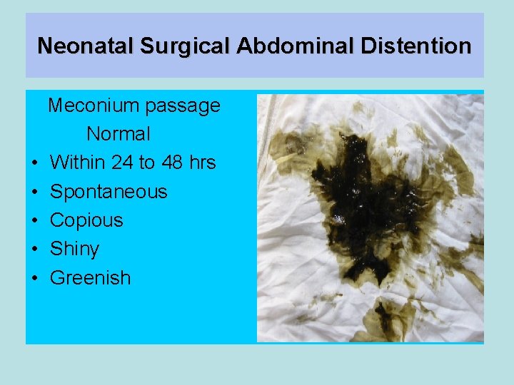Neonatal Surgical Abdominal Distention • • • Meconium passage Normal Within 24 to 48