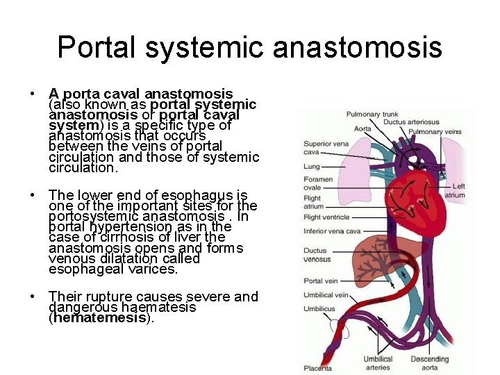 Portal systemic anastomosis • A porta caval anastomosis (also known as portal systemic anastomosis