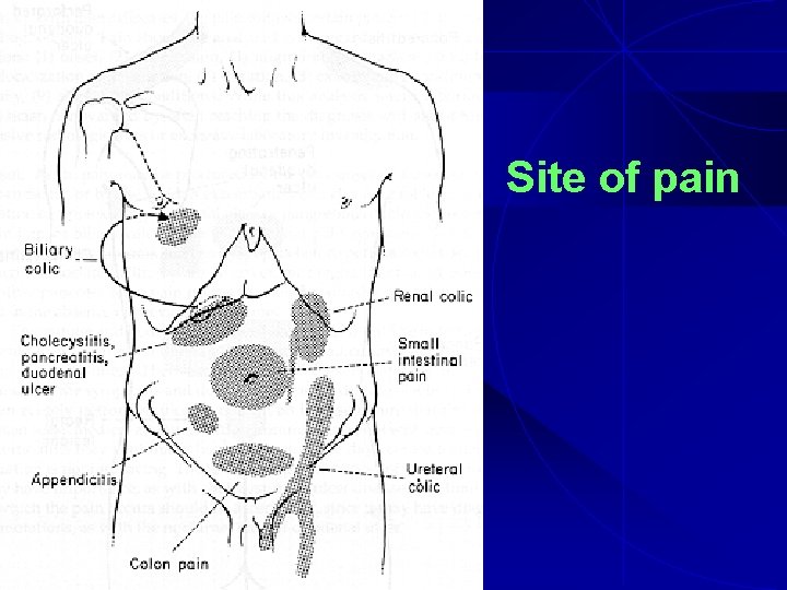 Site of pain 