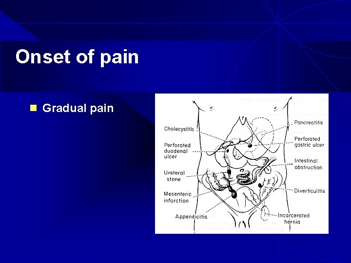 Onset of pain n Gradual pain 