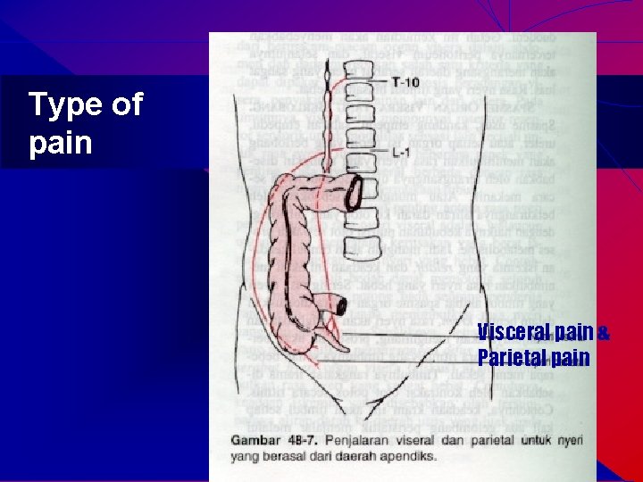 Type of pain Visceral pain & Parietal pain 