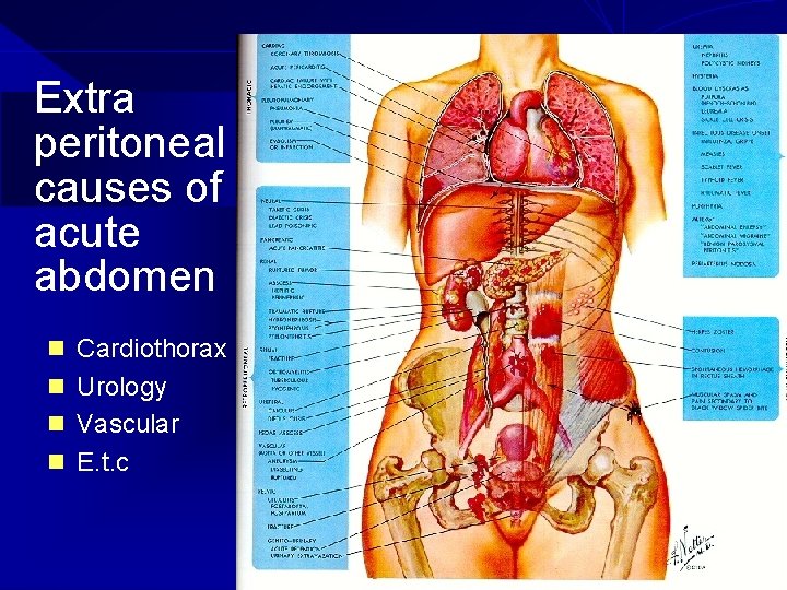 Extra peritoneal causes of acute abdomen n Cardiothorax n Urology n Vascular n E.