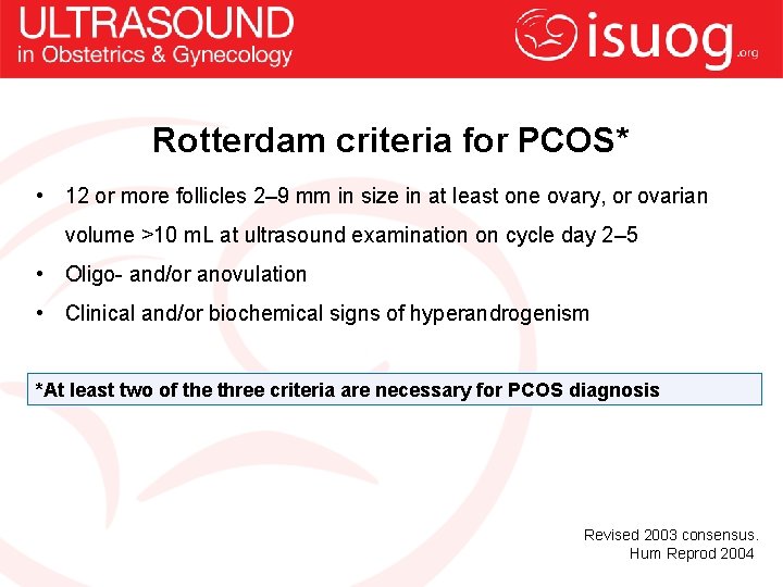 Rotterdam criteria for PCOS* • 12 or more follicles 2– 9 mm in size