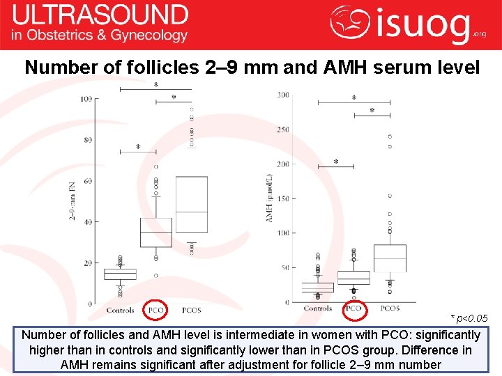 Number of follicles 2– 9 mm and AMH serum level * p<0. 05 Number
