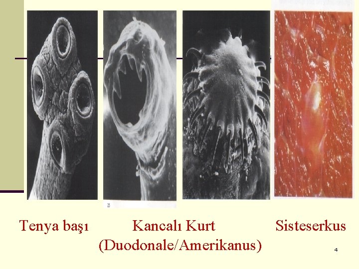 Tenya başı Kancalı Kurt Sisteserkus (Duodonale/Amerikanus) 4 