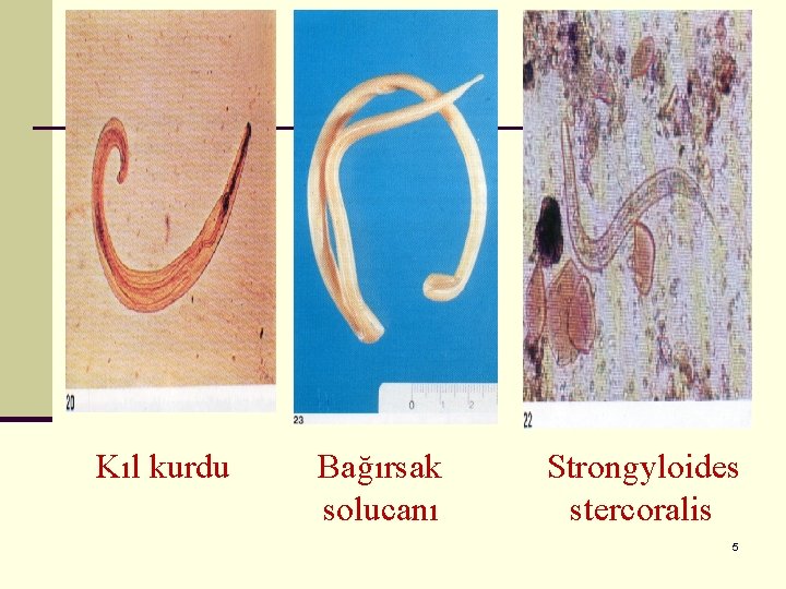 Kıl kurdu Bağırsak solucanı Strongyloides stercoralis 5 