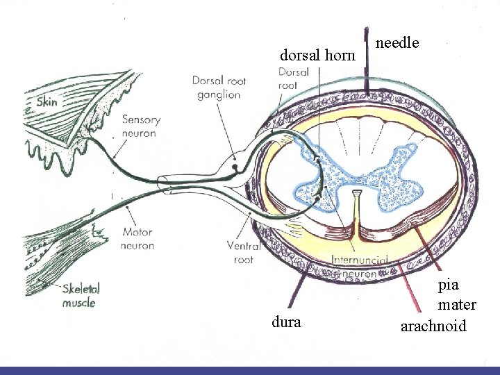 dorsal horn dura needle pia mater arachnoid 