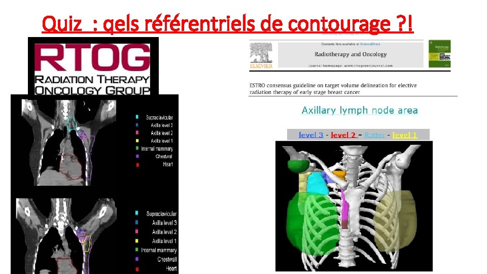 Quiz : qels référentriels de contourage ? ! 